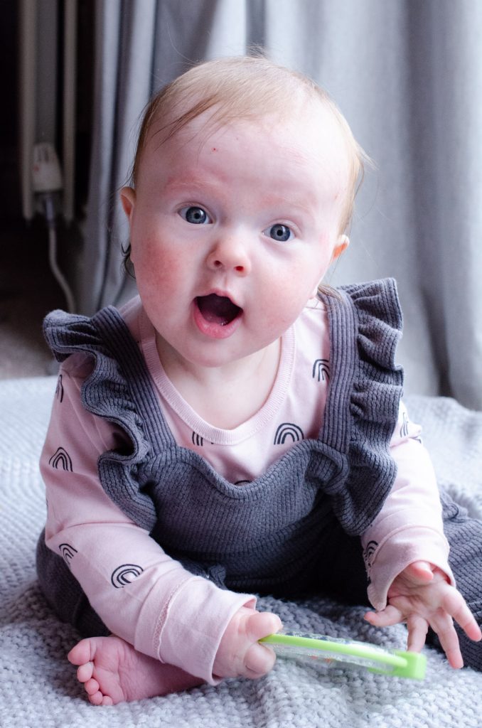 Lydia's skin at 6 months old