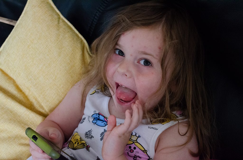 Taking some downtime recovering from chickenpox