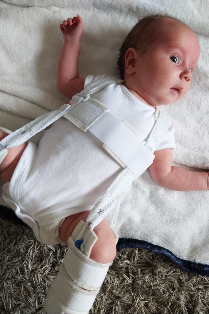 Ellie in the Pavlik harness