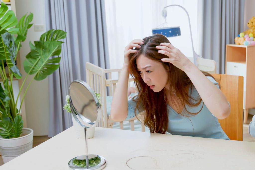 Postpartum hair loss